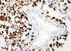 市售p53,克隆号:SP5